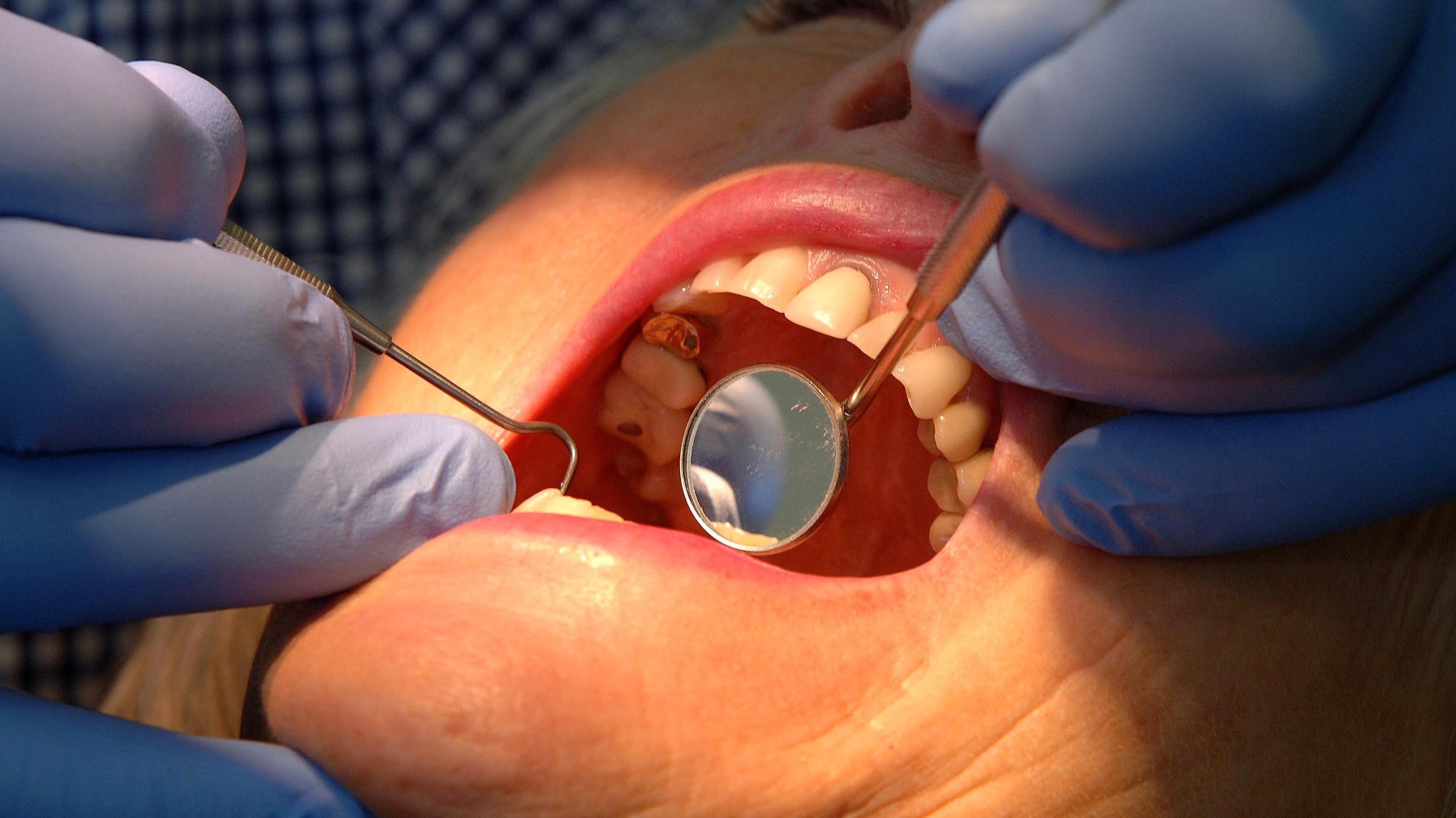 Which? warns private dental patients face a broken complaints system