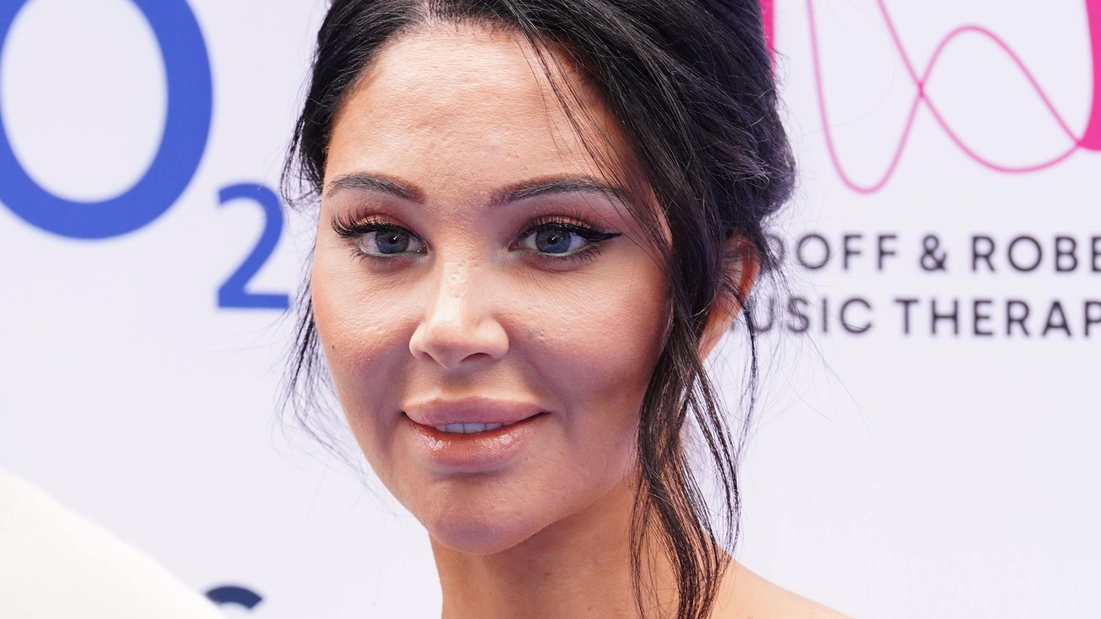 Tulisa reveals ‘minor’ but short-term paralysis after Bell’s palsy attack