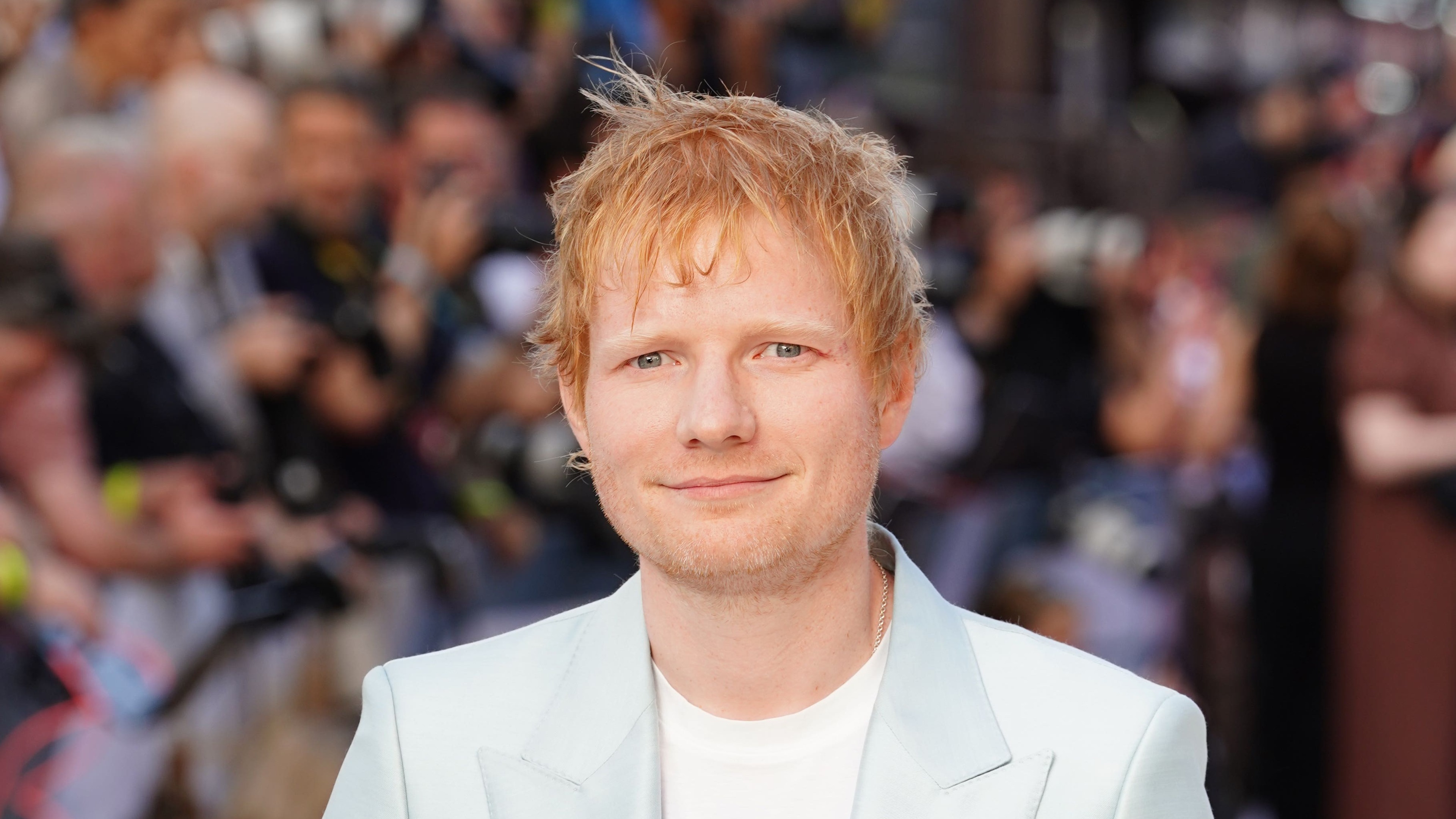 Ed Sheeran reveals he had shingles but is ‘on the mend’