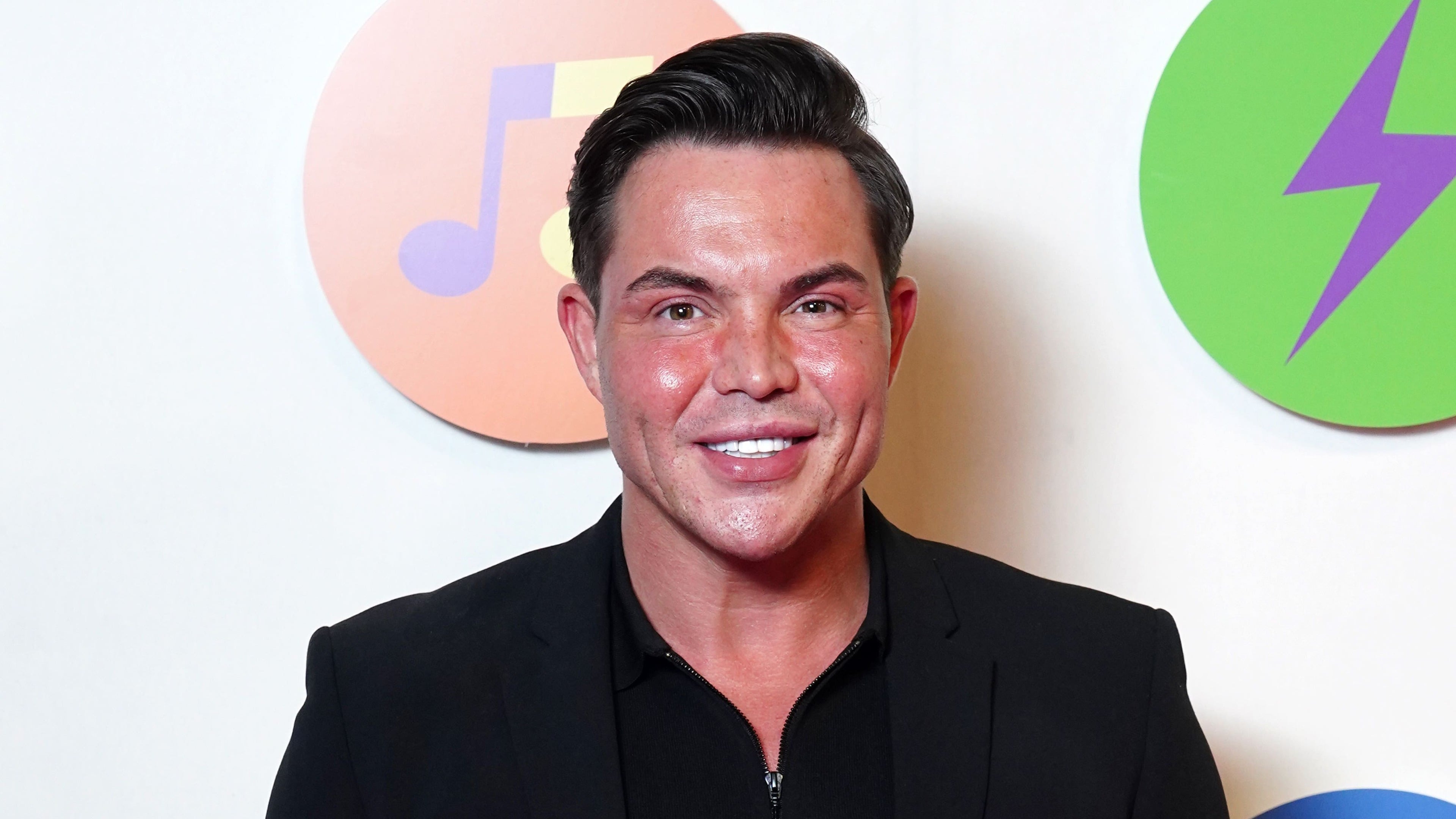 Bobby Norris says plastic surgery has led to comparisons with Katie Price
