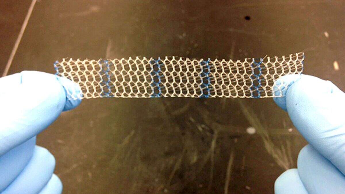 Scottish Government will consider review after mesh implant linked to ...