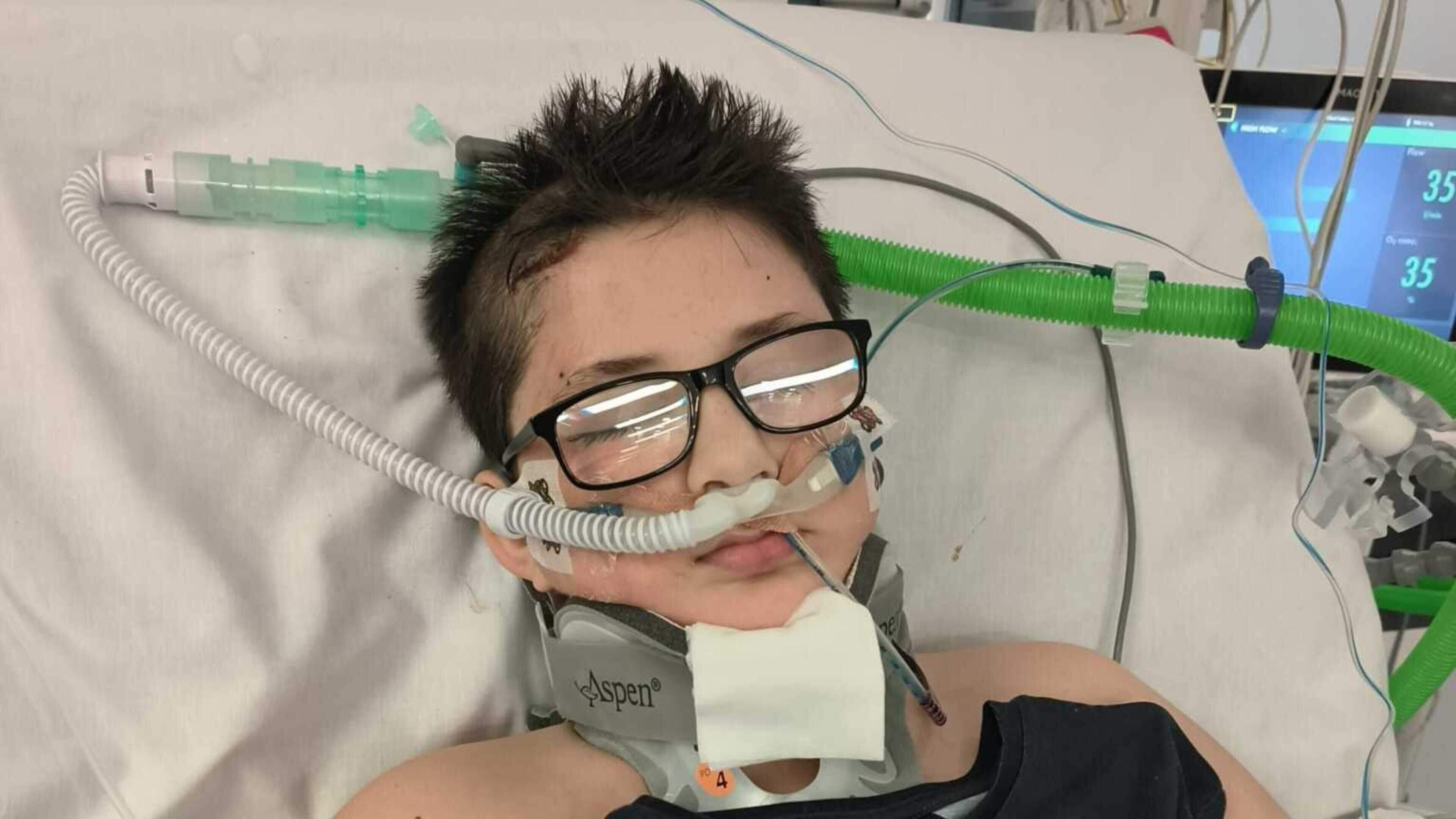 Co Antrim boy left fighting for life after bike crash makes remarkable recovery