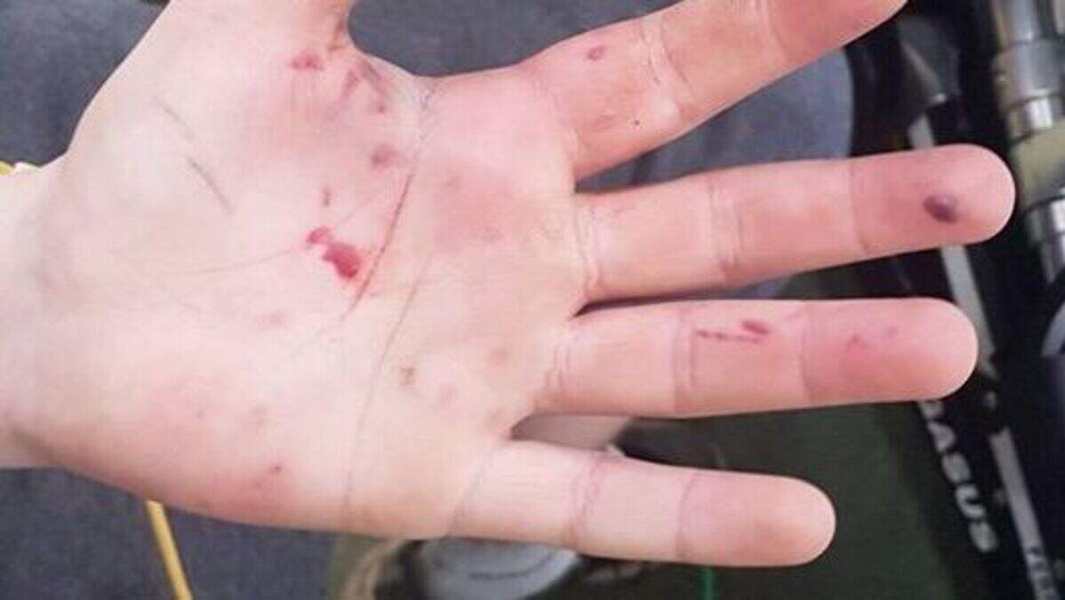 Teenager lucky not to be 'blinded' after firework attack in Larne ...
