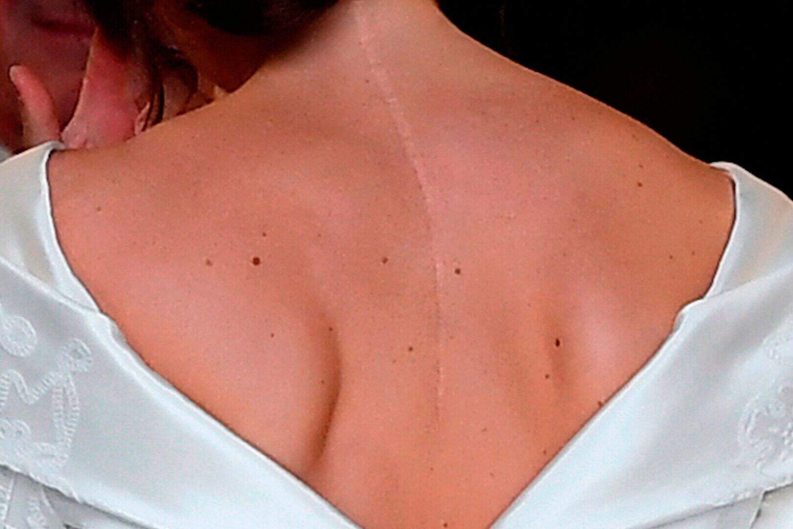 princess eugenie wedding dress scar Princess Eugenie wedding: Royal inspires others by showing scar