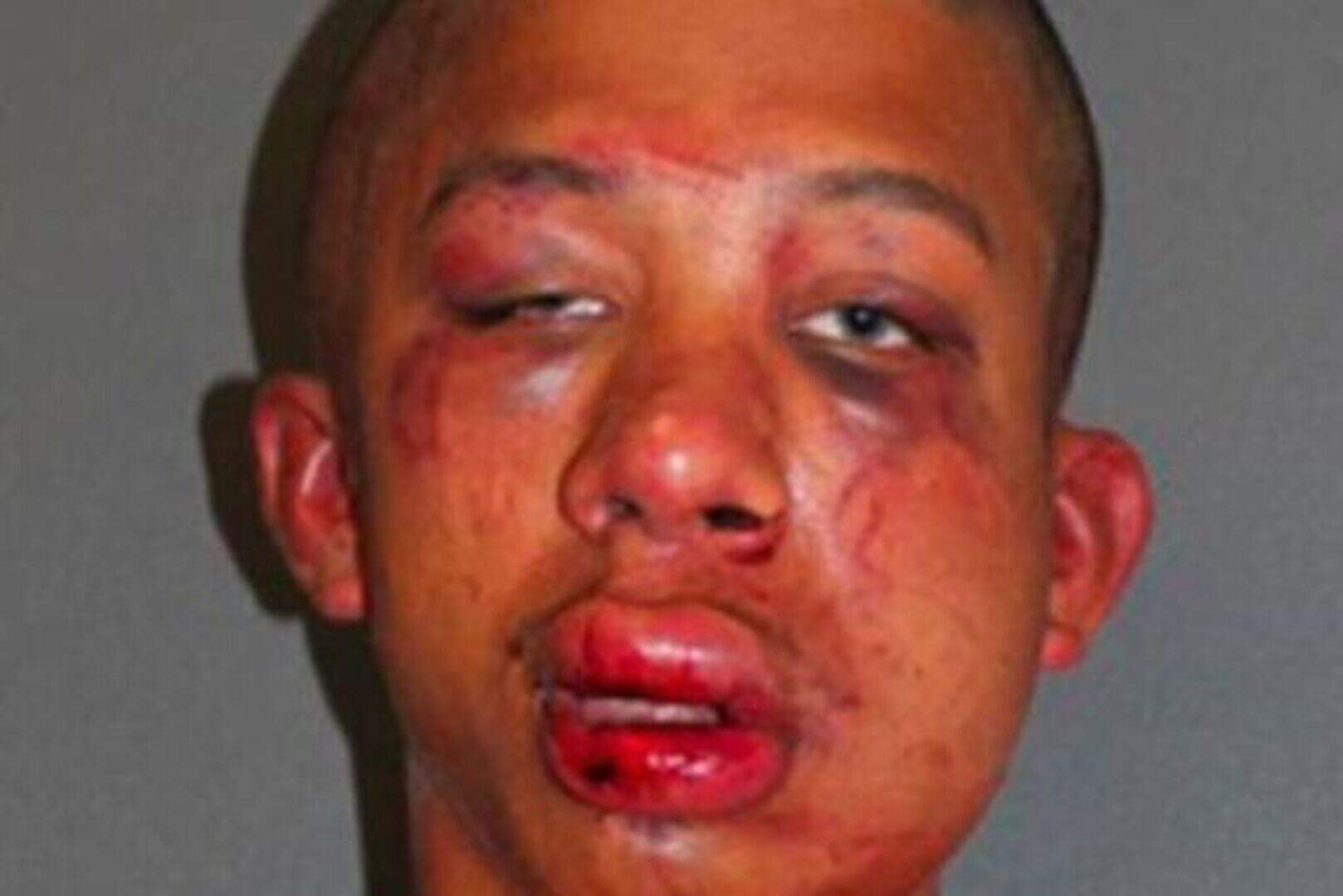 Paedophile Raymond Frolander, beaten unconscious by child's father ...