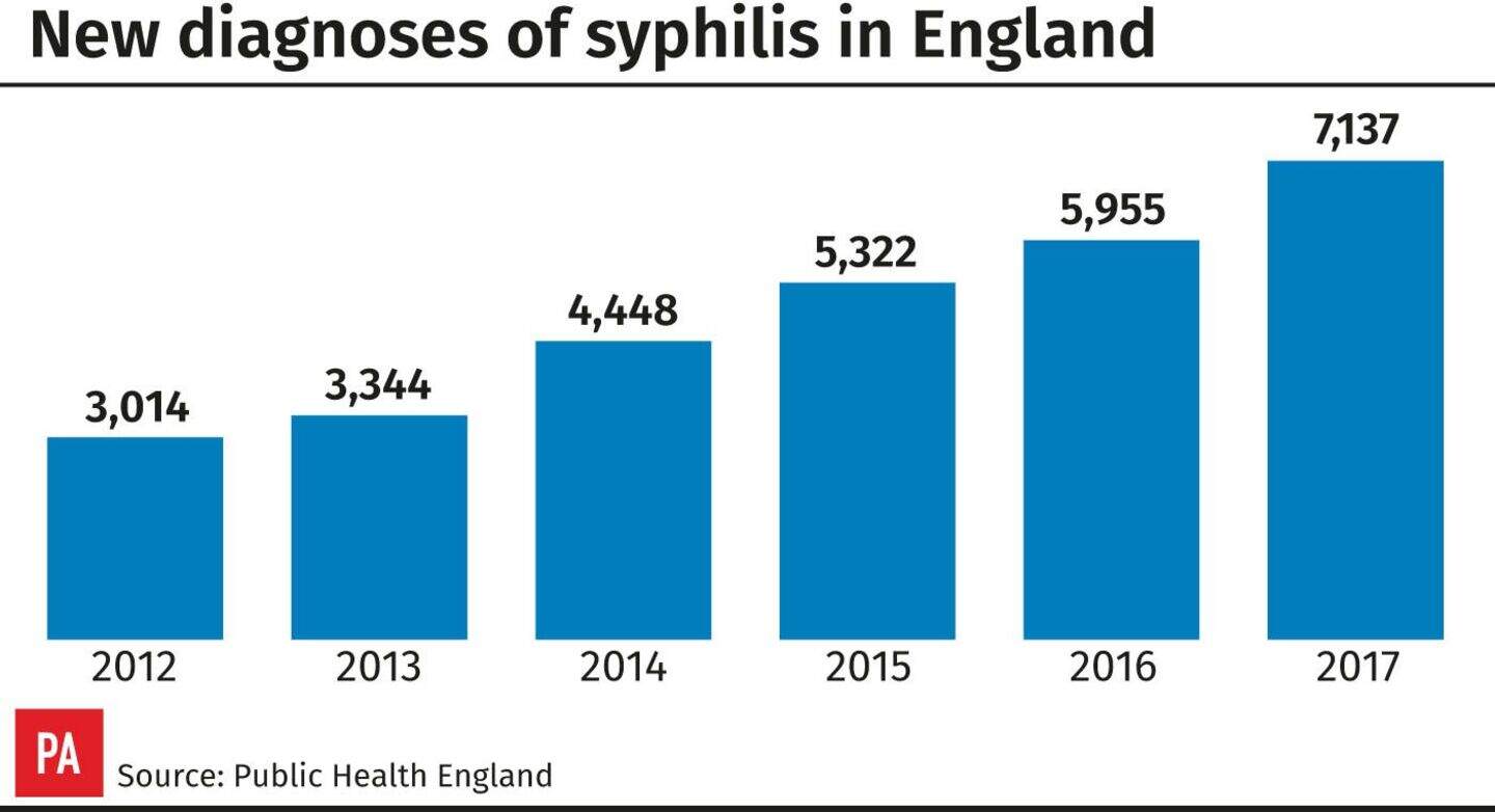 Syphilis diagnoses highest for nearly 70 years | Belfast Telegraph