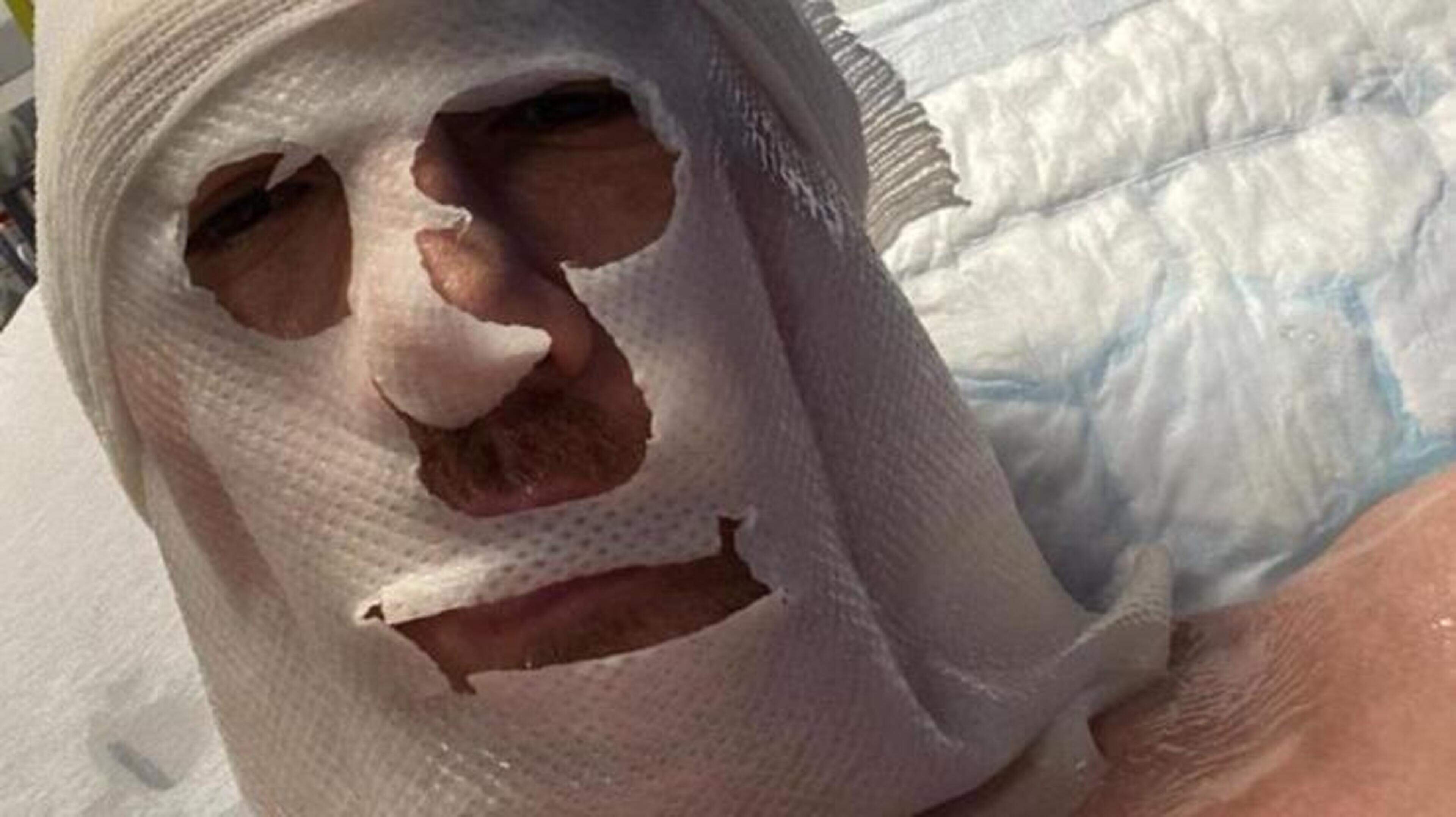 ‘The pain is unbearable’: Victim of boiling water courthouse attack speaks from hospital bed as he reveals he could be left permanently disfigured