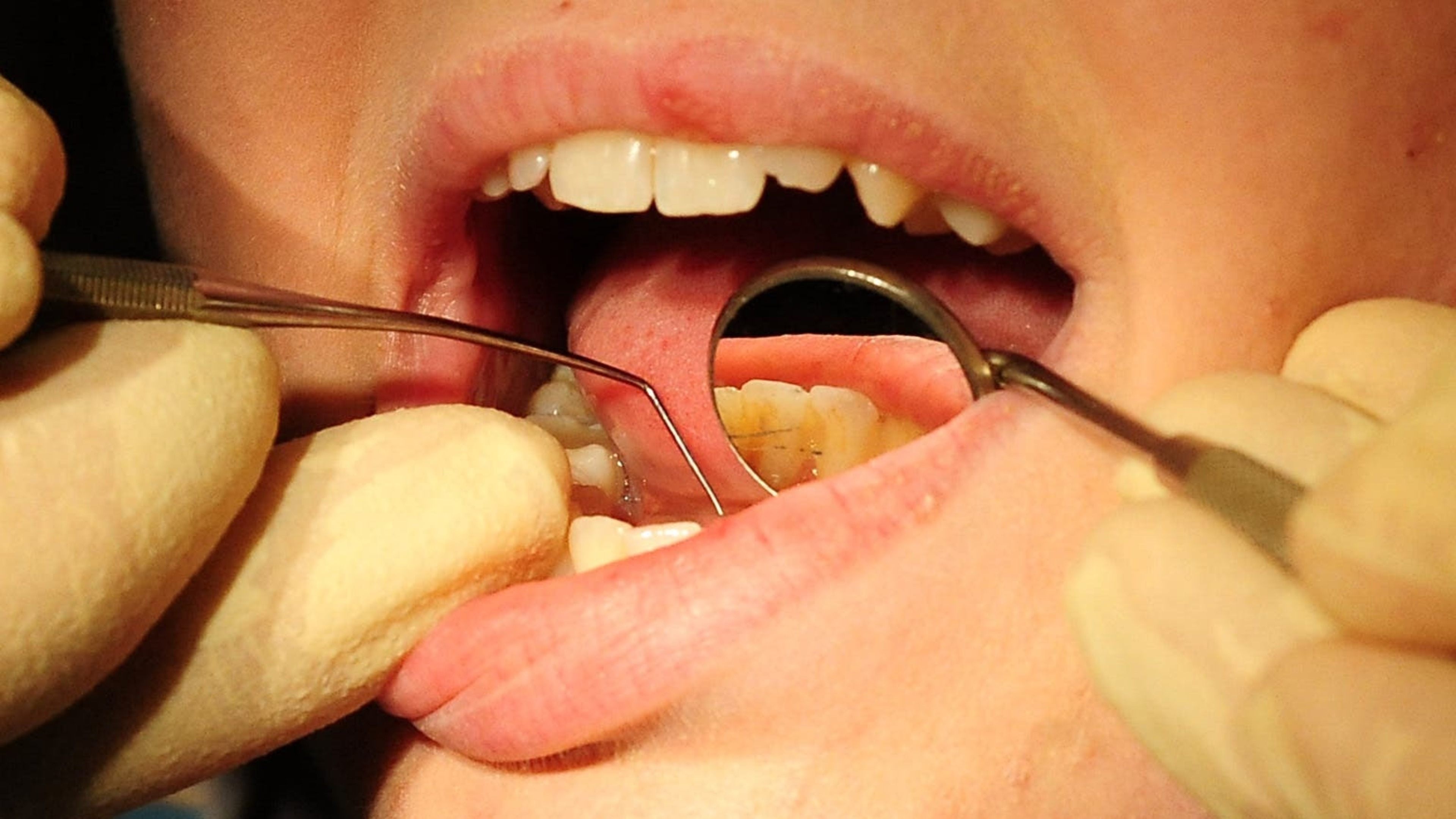 £8m to improve access to dentists announced by Health Minister