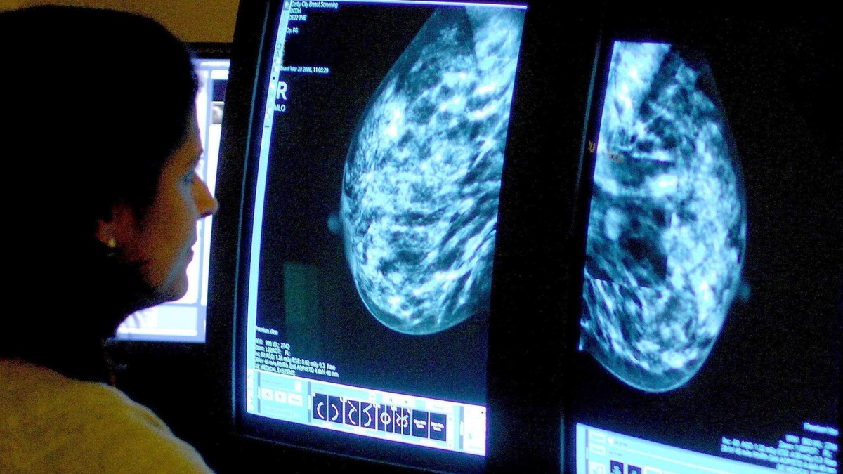 Urgent Breast Cancer Referrals: 1 in 20 Meet 2-Week Target