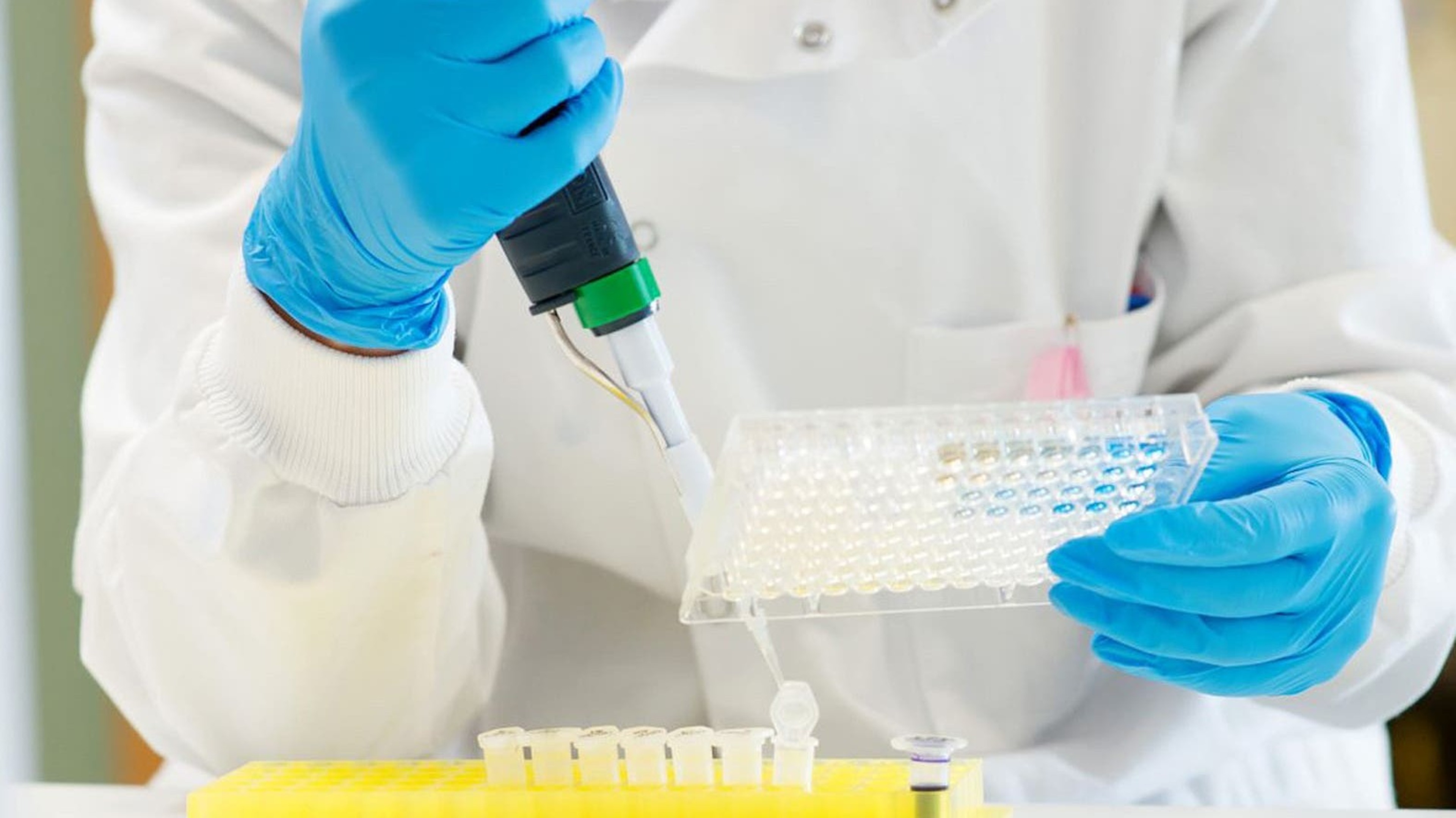 New radiotherapy trial aims to reduce prostate cancer treatment side-effects