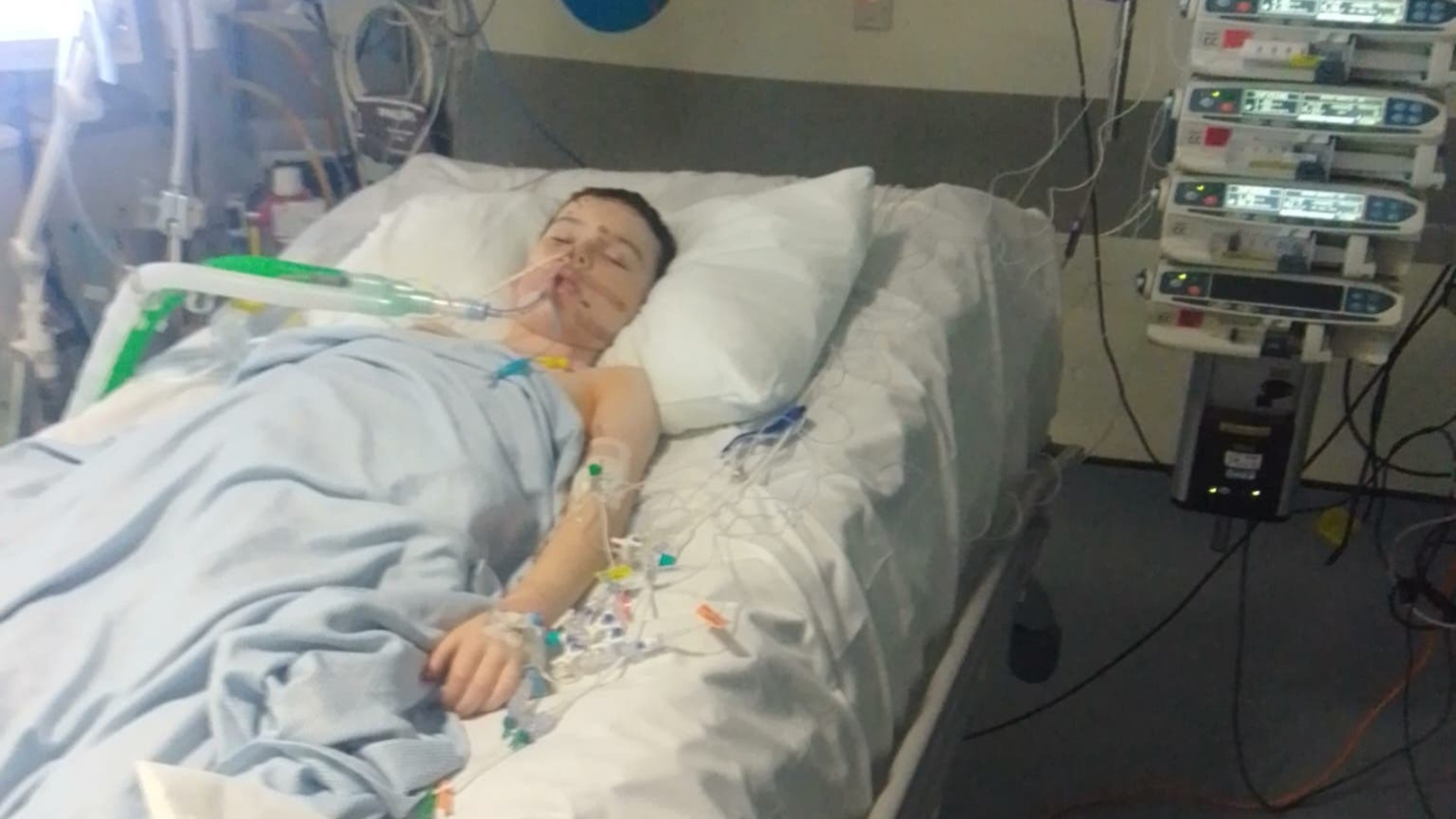 Bonfire Night warning from boy who suffered ‘devastating’ fireworks injuries