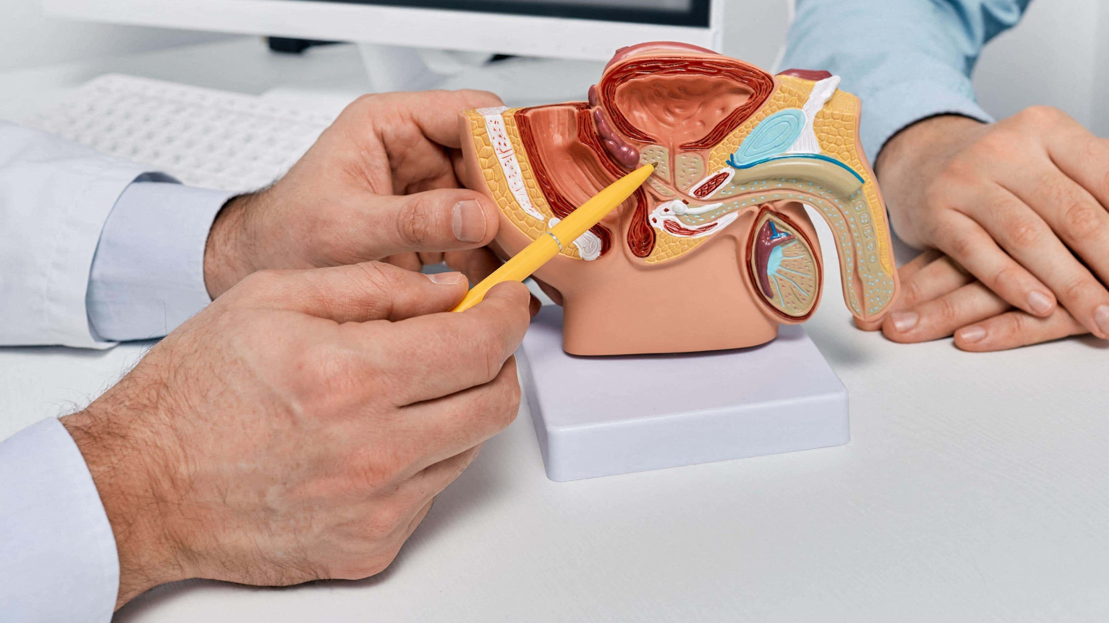 Final prostate cancer screening guidance recommends targeted testing, not screening all men