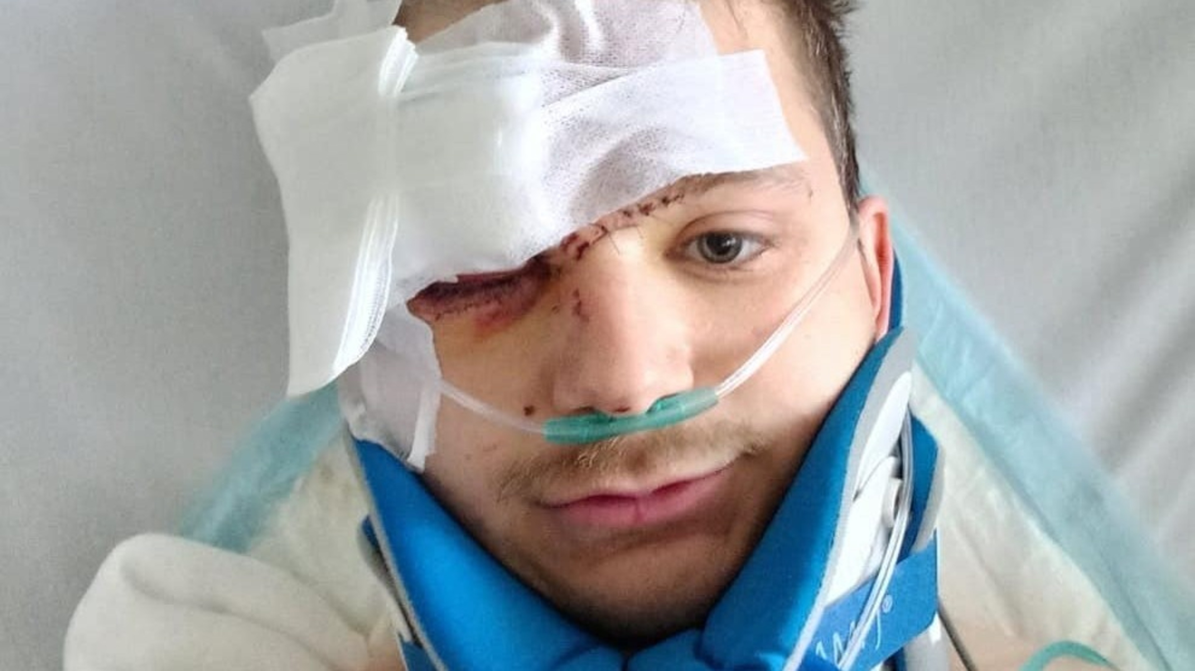 Man’s eye rebuilt after eight painstaking operations following car crash