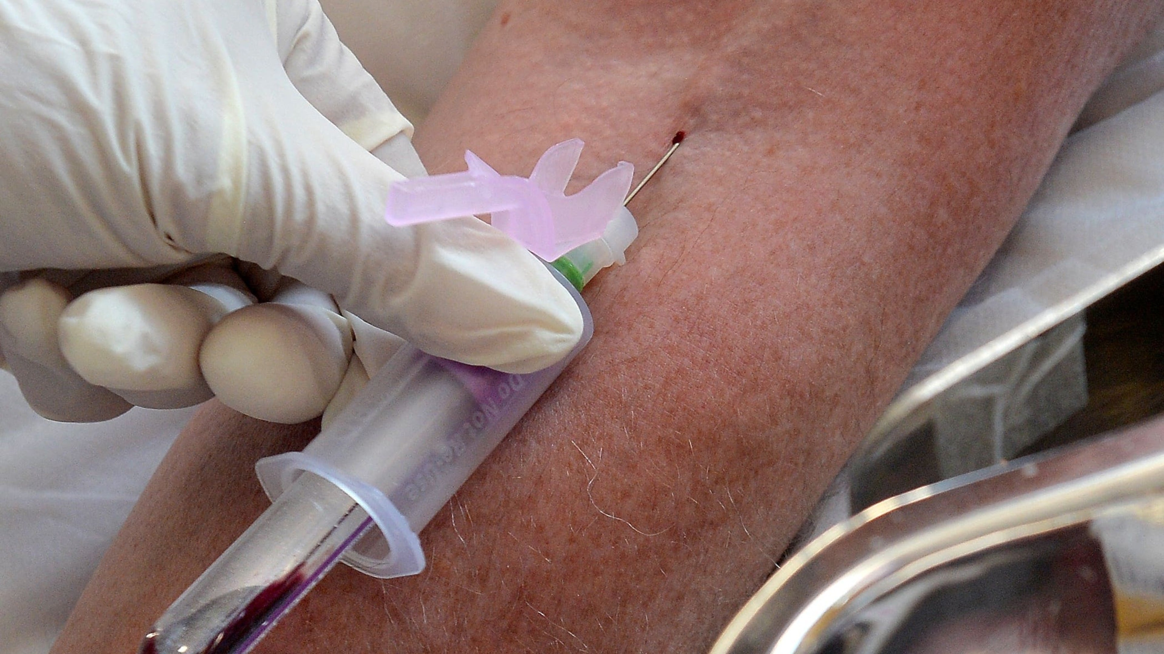 New six-hour test may detect sepsis days earlier than conventional methods