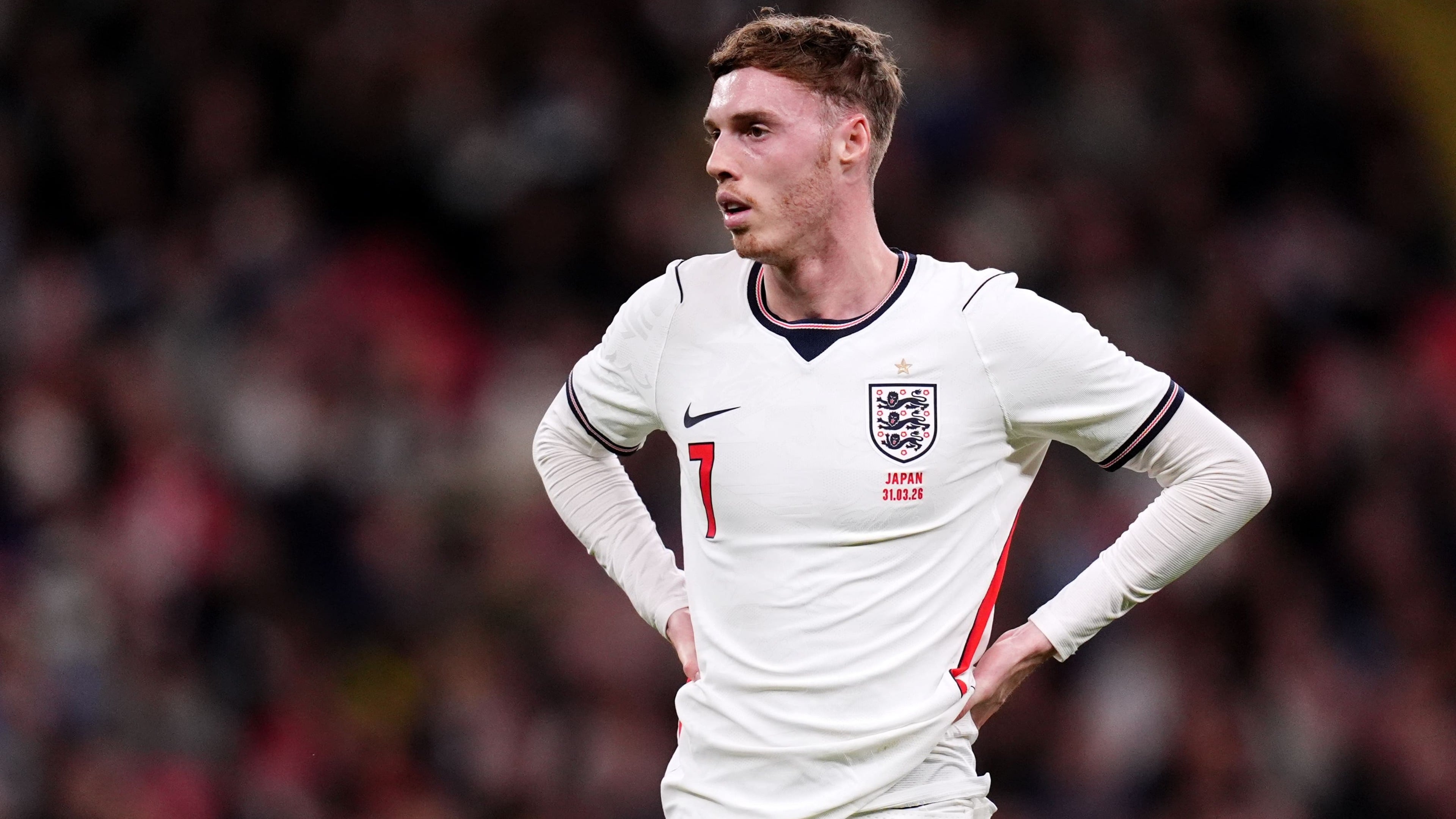 Thomas Tuchel says Cole Palmer misses “too many” England camps due to injuries